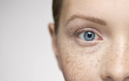 如何判斷臉上是什么斑——圖片輔助解析，臉上斑點的判斷與識別，圖片輔助解析指南