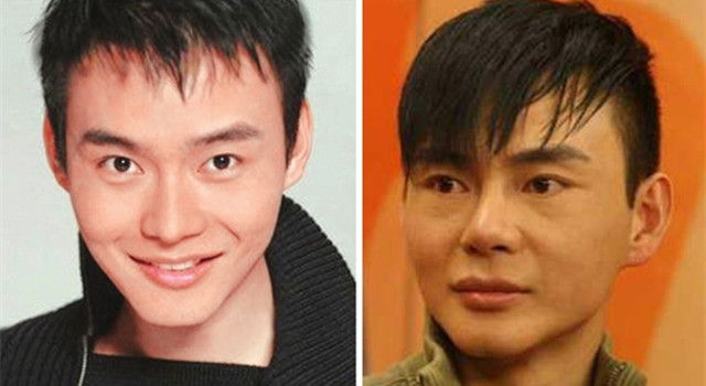 整過容的男明星名單，揭秘娛樂圈的顏值變革之旅，揭秘娛樂圈顏值變革之旅，整過容的男明星名單曝光