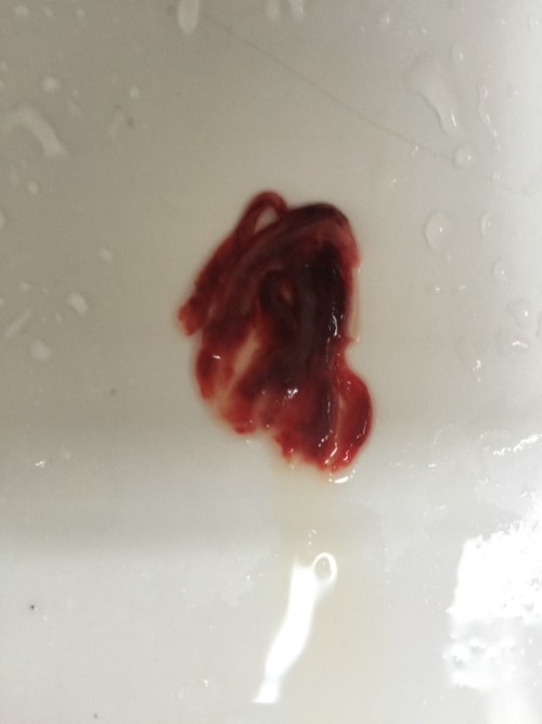 經(jīng)期排出淤血的技巧，優(yōu)化你的生理健康與生活質(zhì)量，經(jīng)期淤血排除技巧，提升生理健康與生活質(zhì)量之道