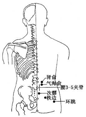 坐骨神經(jīng)痛的治療方法，哪種方式能最快緩解你的疼痛？，坐骨神經(jīng)痛快速緩解方法與治療方式探討