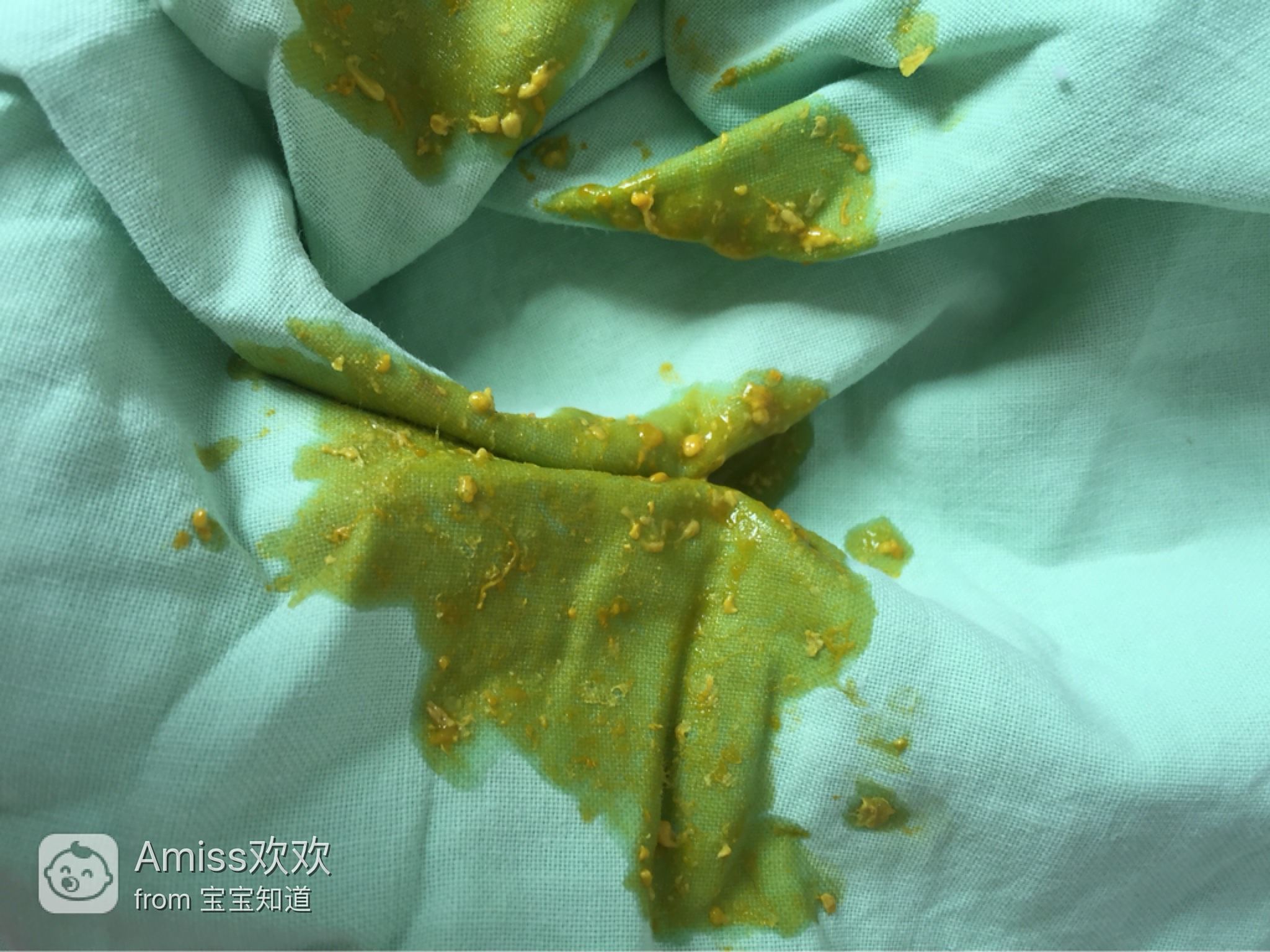 十來(lái)天的嬰兒老是拉稀怎么辦？全面解析寶寶腹瀉應(yīng)對(duì)之策，嬰兒腹瀉應(yīng)對(duì)指南，全面解析寶寶拉稀怎么辦？