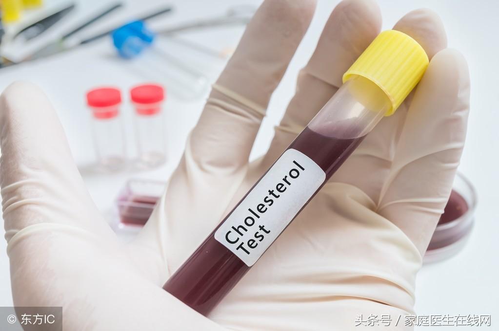 糖尿病的成因，深度解析其背后的原因，深度解析糖尿病成因，揭示背后原因真相