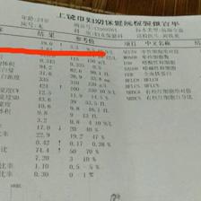 白細(xì)胞高說明什么，解讀身體信號背后的真相，解讀身體信號，白細(xì)胞升高揭示的健康真相