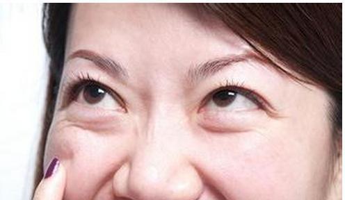 如何消除眼袋，方法與技巧詳解，消除眼袋的有效方法與技巧全解析