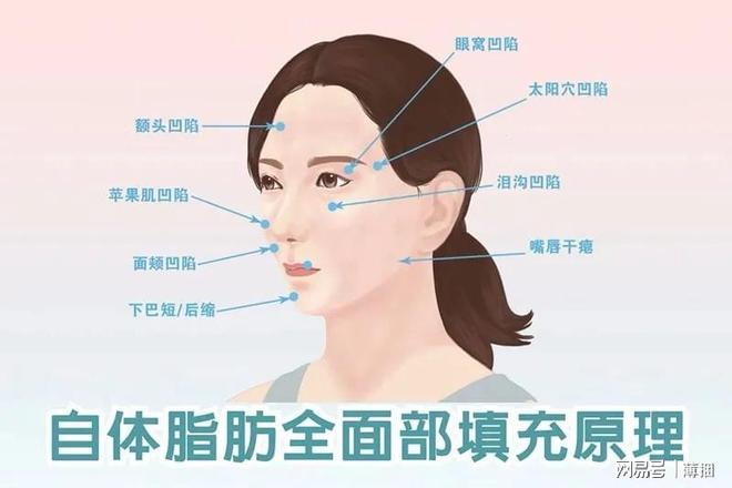 脂肪填充后幾天開始存活，全面解析脂肪填充過程及其恢復(fù)時(shí)間，全面解析脂肪填充過程，術(shù)后幾天脂肪開始存活及恢復(fù)時(shí)間揭秘