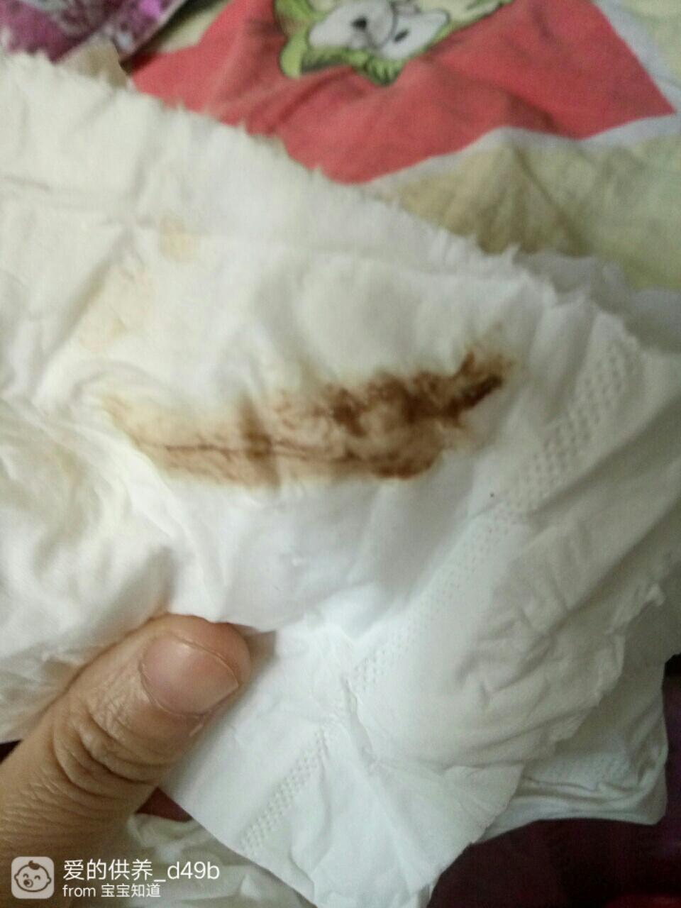 懷孕后流褐色血是好事嗎？——深入了解孕期出血真相，孕期流褐色血是好事嗎？揭秘孕期出血真相