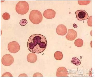 地中海貧血能生小孩嗎，全面理解與生育決策，地中海貧血患者的生育決策，全面理解與探討