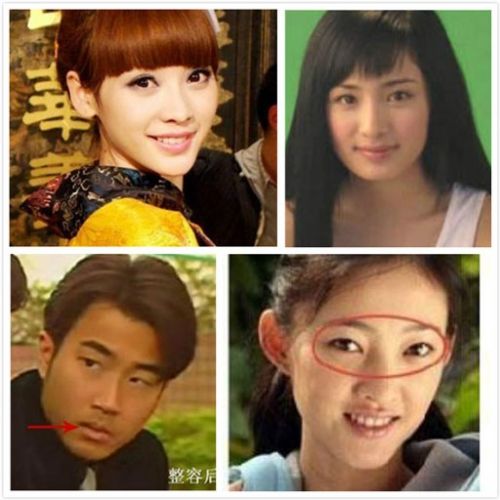 整容失敗明星整容前后圖片，深度探討與反思，整容失敗的明星，前后對(duì)比與深度探討反思