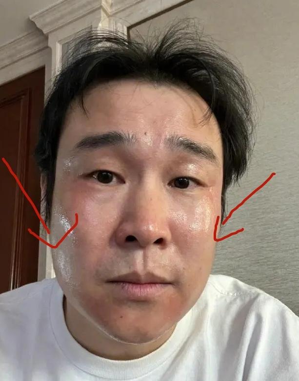 頭痛欲裂，感覺要爆炸了怎么辦？全面解析頭痛原因與應對之策，頭痛欲裂，緊急解析原因與應對之策，全面攻略助你擺脫頭痛困擾