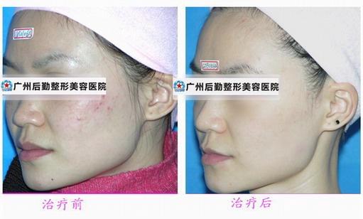 揭秘祛斑秘籍，如何有效祛斑？，揭秘祛斑秘籍，有效祛斑方法與技巧探討