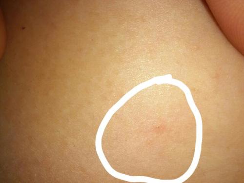 乳房一碰就疼，原因、診斷與治療方法，乳房疼痛，原因解析、診斷方法及治療策略