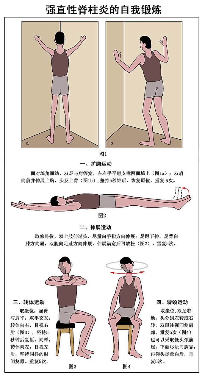 強(qiáng)直性脊柱炎早期自測(cè)指南，強(qiáng)直性脊柱炎早期自我檢測(cè)指南